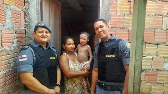 Policiais Militares do CPA Leste realizam campanha para ajudar criança com doença rara de pele