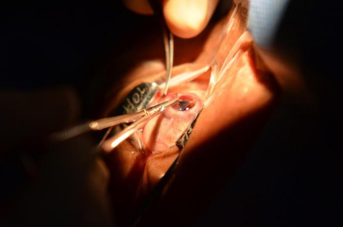 Pará registra maior número de doações de córnea em mais de três décadas