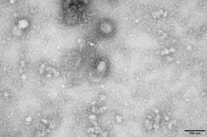 Brasil tem 9 casos suspeitos de coronavírus; testes estão em andamento