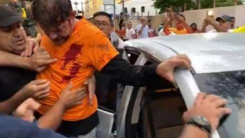 Senador Cid Gomes é atingido por disparo durante protesto no Ceará