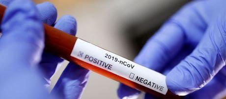 Segundo caso de coronavírus no Brasil é confirmado em SP