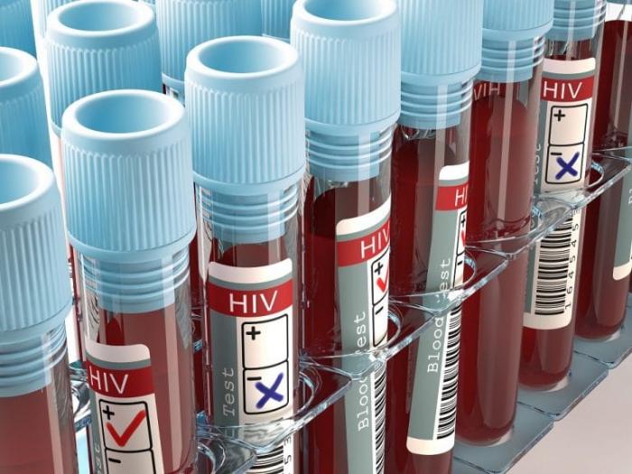 Oxford inicia testes de vacina contra o HIV