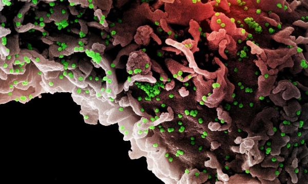 PFIZER: comprimido antiviral reduz risco de covid-19 grave em 89%
