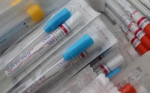 BRASIL: Anvisa aprova 1º teste para diagnosticar monkeypox