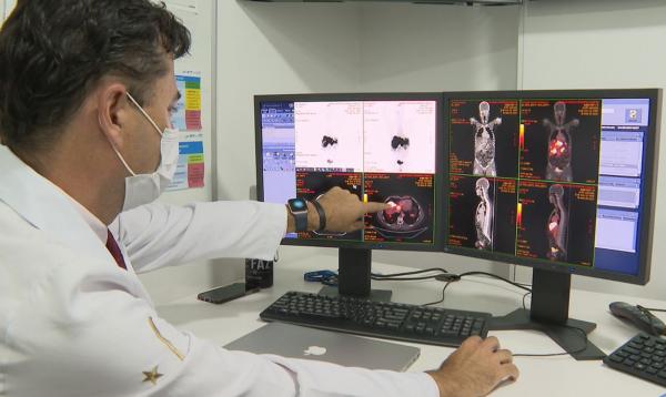 Brasil terá 44 mil casos novos de câncer colorretal em 2023, prevê INCA