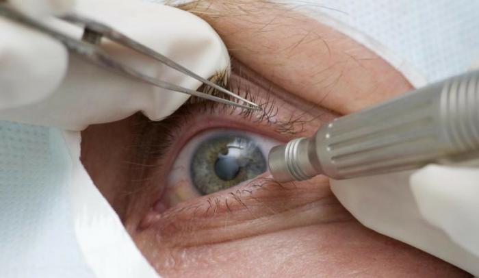 Entidades médicas cobram regras sanitárias em mutirões de cirurgias