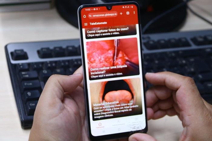 Aplicativo da SES-AM identifica 37 casos suspeitos de câncer bucal no Amazonas