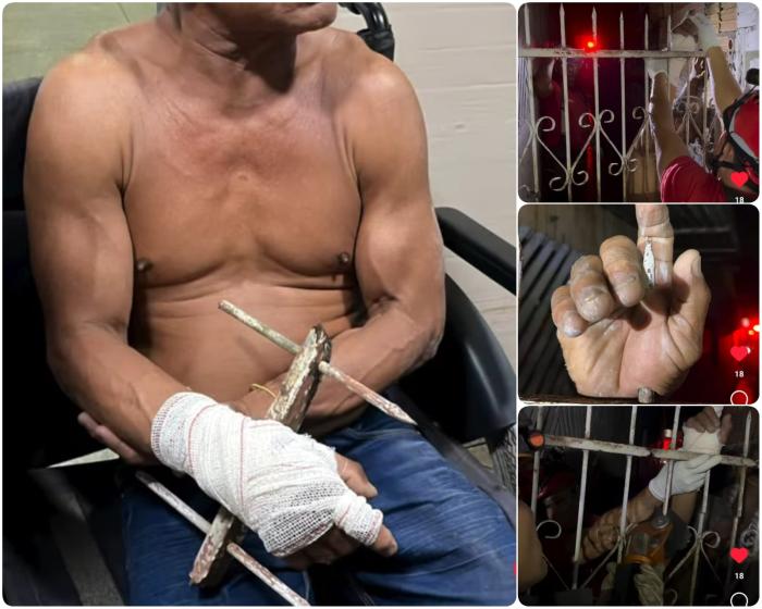 Homem fica com braço transifixado em portão e é resgatado pelos Bombeiros em Parintins
