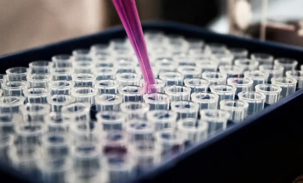 Cientistas brasileiros avançam em novas técnicas de diagnóstico do Alzheimer