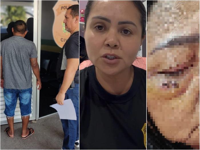 Agressão grave leva mulher a hospital de Parintins e resulta na prisão do agressor