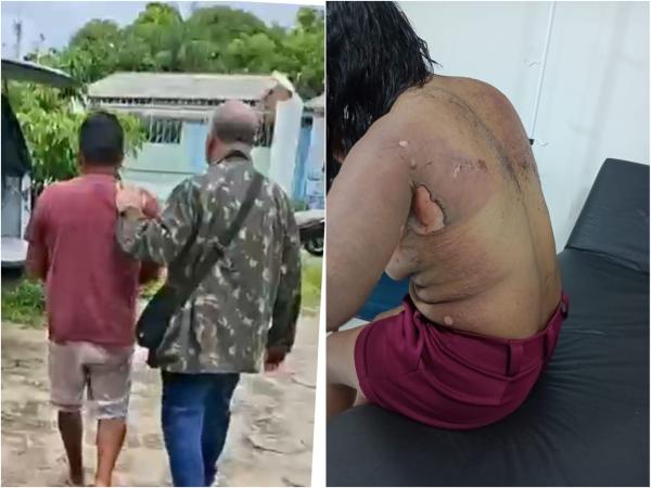 VÍDEO: Homem que tacou fogo em mulher é preso em Parintins