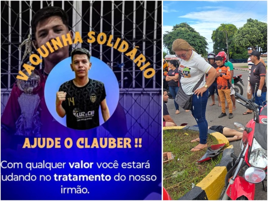 GRAVE: Informado estado de saúde de jovem vítima acidente em Parintins; Família pede ajuda